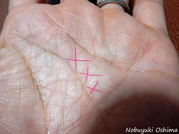 神秘十字線（左手の手相）