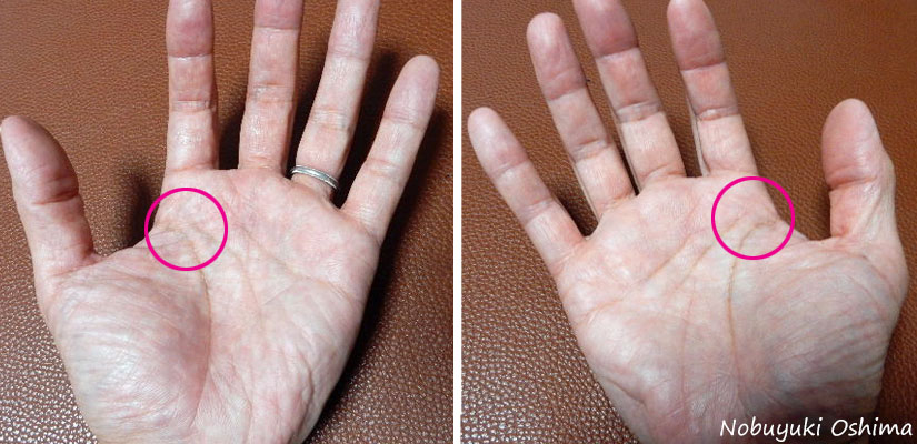 「両手離れ型（りょうてはなれがた）」の手相