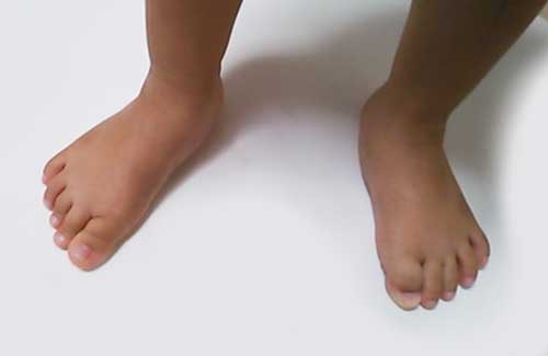 1才児の足、1才半の足